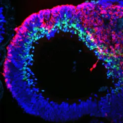 a human stem cell derived retinal organoid stained with antibodies for RECOVERIN (red, =photoreceptors) and AP2 (green, = amacrine cells). The lamination of the tissue and position of the cells is similar to a human retina. 